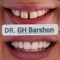 Advanced Dental Procedure